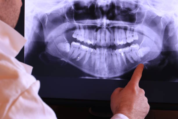 Best Emergency Treatment for Dental Infections or Abscesses in Star, ID